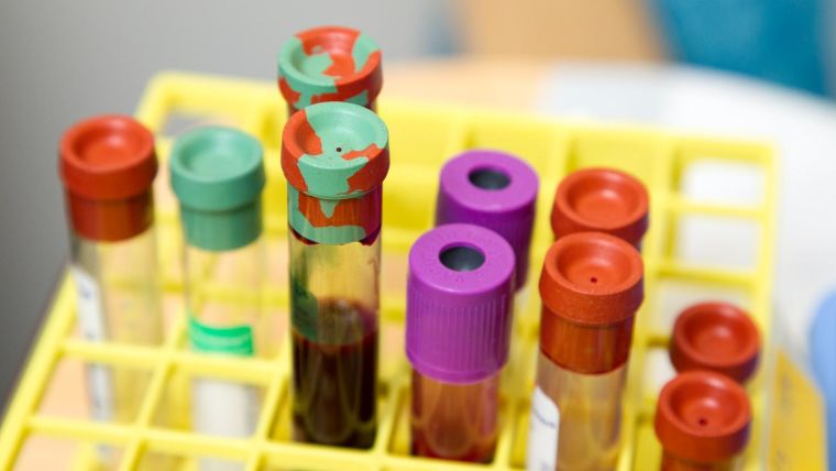 A photo of various types of blood sample collection tubes